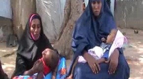 U gar gaar Labadan caruur ee ku xanuunsan Magaalada Muqdisho(Sawiro)